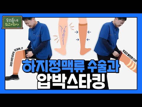 하지정맥류와 압박스타킹의 상관관계?!