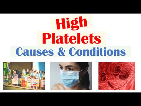 Causes of High Platelets (Thrombocytosis) | Rapid Review