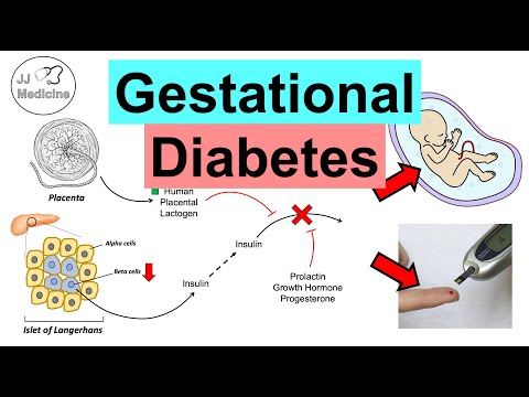 Gestational Diabetes (Pregnancy Diabetes) | Causes, Risk Factors, Symptoms, Consequences, Treatment