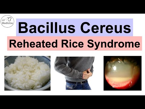 Bacillus Cereus (Reheated Rice Syndrome) Food Poisoning, Pathology, Symptoms, Diagnosis, Treatment