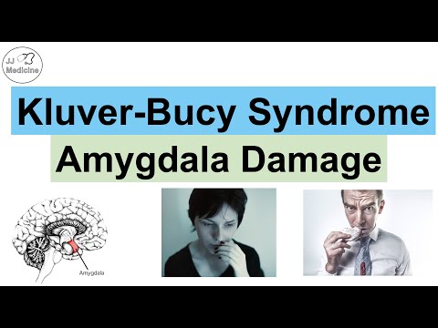 Kluver-Bucy Syndrome | Causes, Pathophysiology, Signs & Symptoms, Diagnosis, Treatment