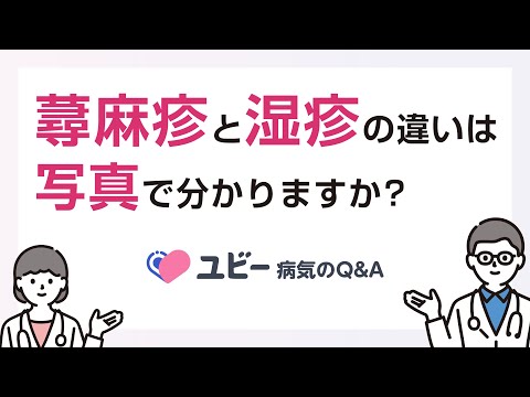 蕁麻疹と湿疹の違いは写真で分かりますか？【ユビー病気のQ&A】