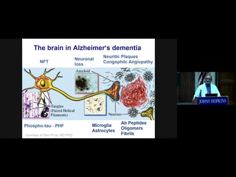 Johns Hopkins Psychiatry Grand Rounds | Three Hot Topics in Alzheimer’s Disease