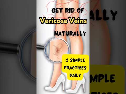 Vericose veins problem? Then must try this daily.. #vericoseveins #yogaformoms #YogPrakrutiStudio