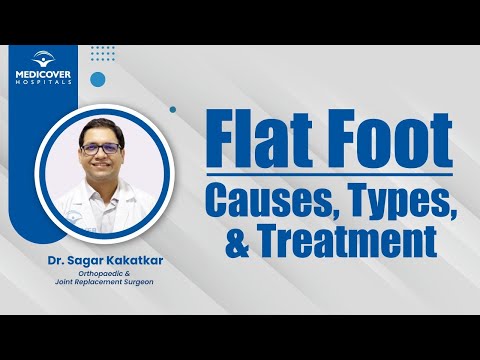 Flat Foot: Causes, Types, and Treatment | Medicover Hospitals