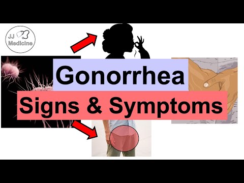 Gonorrhea Signs and Symptoms & Complications (& Why They Occur)