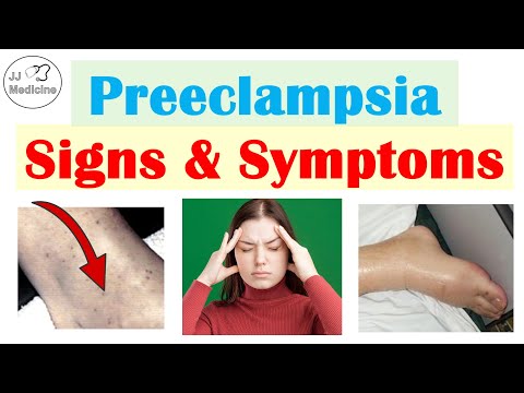 Preeclampsia: Signs & Symptoms You Have To Watch Out For