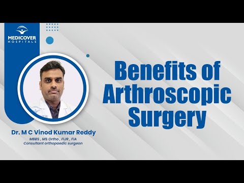 Benefits of Arthroscopic Surgery | Medicover Hospitals