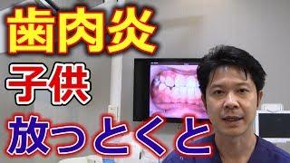 子供の歯肉炎を放って置くとどうなるのか？【千葉市中央区の歯医者】 1