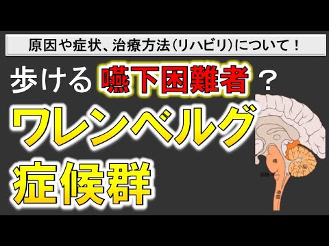 【歩けるけど嚥下障害】ワレンベルグ症候群とは？