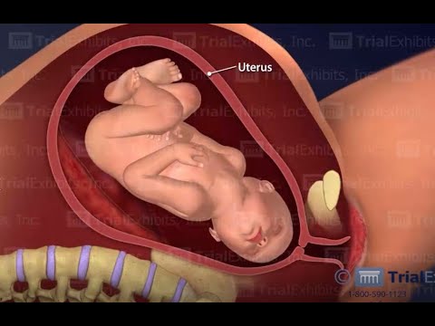 Face Presenting Labor and Delivery