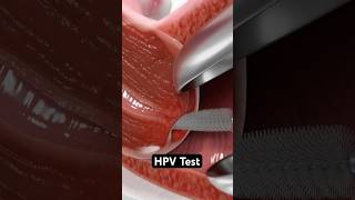 HPV Test (3D Animation)