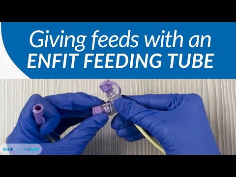 How to give feeds with an ENFit feeding tube | AboutKidsHealth at The Hospital for Sick Children