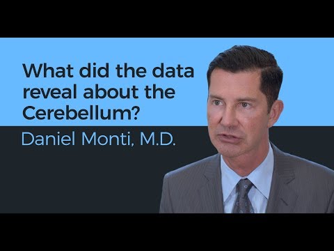 What did the data reveal about the Cerebellum? - Daniel Monti, M.D.