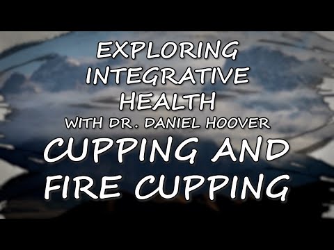 Exploring Integrative Health with Dr. Daniel Hoover: Cupping and Fire Cupping