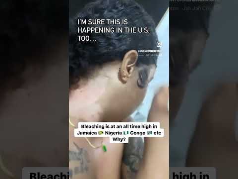 Colorism & Skin Bleaching - The Toxic Twins - What Are Your Thoughts?