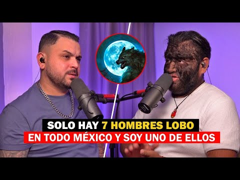 MI VIDA COMO HOMBRE LOBO Y PORQUE NACÍ ASÍ | Alex # 290