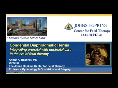 Management Advances for Congenital Diaphragmatic Hernia—Integrating Fetal and Postnatal Care Webinar