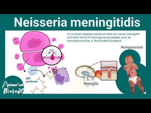 Neisseria meningitidis | Pathogenesis, diagnosis and treatment.