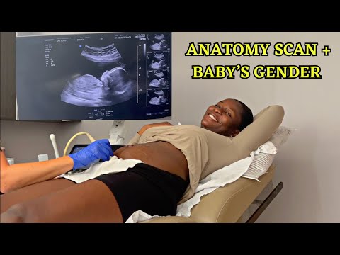 20 Weeks Anatomy Scan and Finding Out the Gender