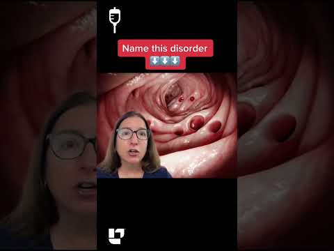 Name this Disorder 18: Medical Surgical SHORT | @LevelUpRN