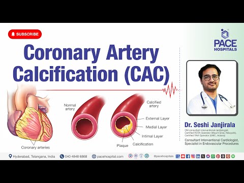 Coronary Artery Calcification (CAC) - Causes, Symptoms, Diagnosis, Treatment & Preventions