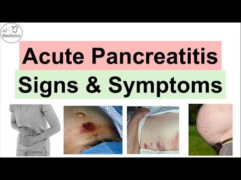 Acute Pancreatitis Signs & Symptoms (& Why They Occur)