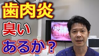 歯肉炎に臭いはあるのか？【千葉市中央区の歯医者】