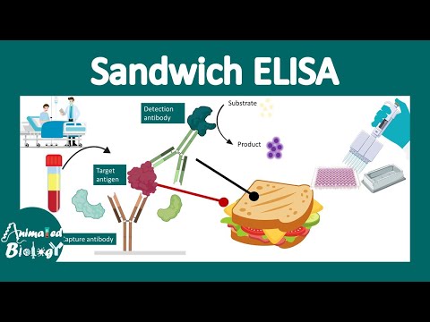 Sandwich ElISA | Principle and application of Sandwich ELISA | Techniques in biology