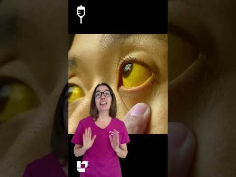 Jaundice - What is it? Causes? - Ask Nurse Cathy: Medical Surgical SHORT | @LevelUpRN