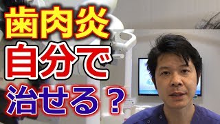 歯肉炎は自分では治せないのか？【千葉市中央区の歯医者】