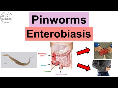 Pinworms (Enterobiasis) | Infection, Transmission, Symptoms, Diagnosis, Treatment